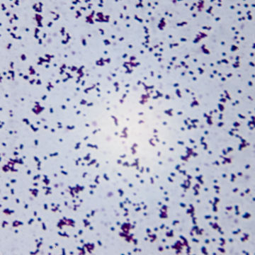 Visa information för Bakteriologi Bild på Bakteriologi