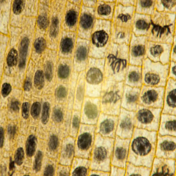 Visa information för Embryologi - Celldelning - Kromosomer Bild på Embryologi - Celldelning - Kromosomer