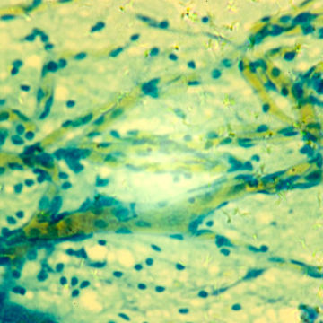 Visa information för Histologi - Bindväv Bild på Histologi - Bindväv