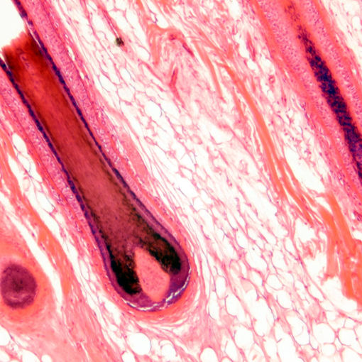 Bild på Histologi - Hud