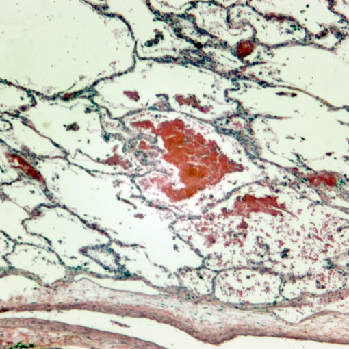 Bild på Histologi - Andningssystemet