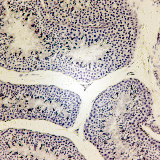 Bild på Histologi - Fortplantning & Urinvägarna