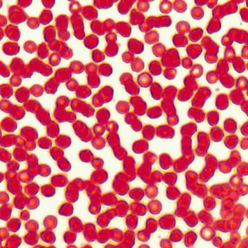 Visa information för Histologi - Crikulationssystemet Bild på Histologi - Crikulationssystemet