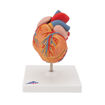 Bild på Hjärta vänster ventrikulär hypertrofi G04 1000261