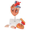 Bild på Hjärta esofagus & trakea G13 1000269