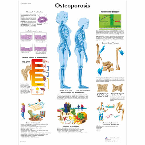 Bild på Osteoporos VR1121 1001472