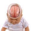 Bild på Shaken baby syndrome W43117 1017928