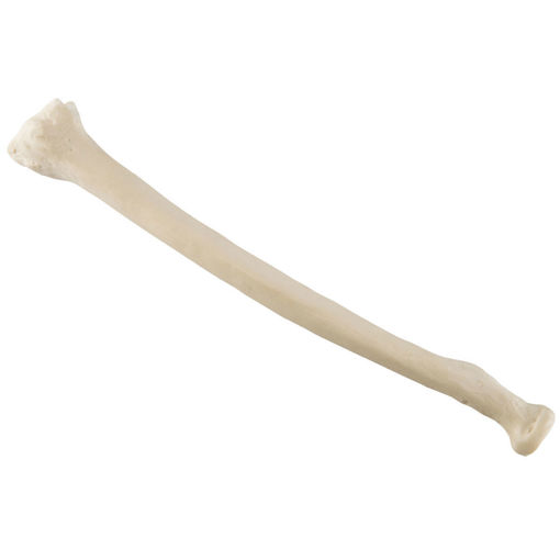 Bild på Radius höger ORTHOBone 1019605