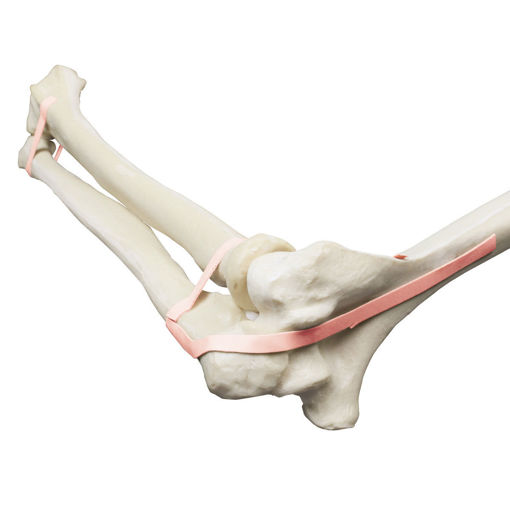 Bild på Armbåge, Ulna, Radius ORTHOBone Pre 1018335