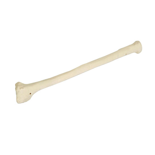 Bild på Radius höger ORTHOBone Pre 1005122