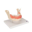 Bild på Tandsjukdommer D26 1000016