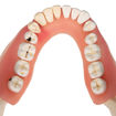 Bild på Tandsjukdommer D26 1000016
